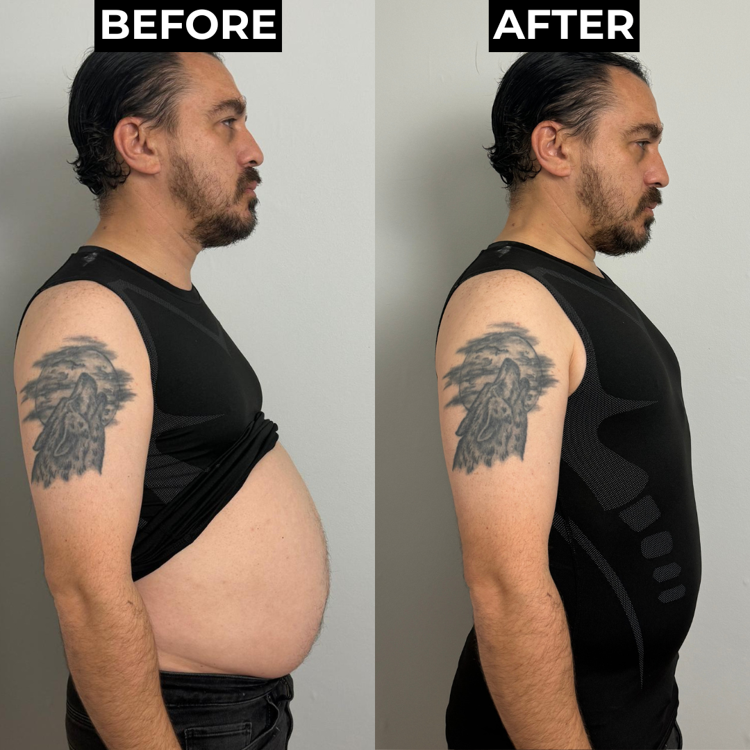 SlimFlex™ | Feel The Power of Confidence, Shape & Control